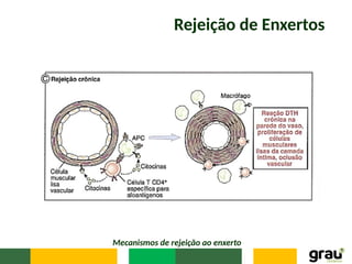 Rejeição de Enxertos
Mecanismos de rejeição ao enxerto
 
