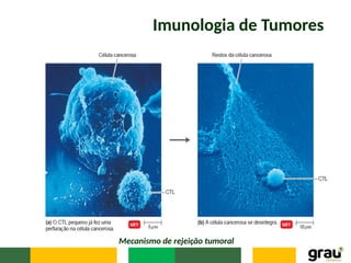 Imunologia de Tumores
Mecanismo de rejeição tumoral
 