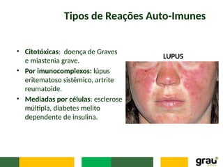 Tipos de Reações Auto-Imunes
• Citotóxicas: doença de Graves
e miastenia grave.
• Por imunocomplexos: lúpus
eritematoso sistêmico, artrite
reumatoide.
• Mediadas por células: esclerose
múltipla, diabetes melito
dependente de insulina.
LUPUS
 