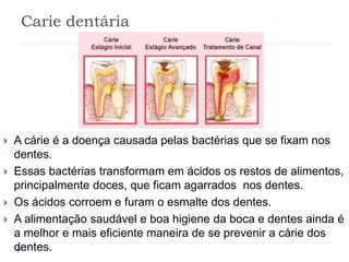 Carie dentária
 A cárie é a doença causada pelas bactérias que se fixam nos
dentes.
 Essas bactérias transformam em ácidos os restos de alimentos,
principalmente doces, que ficam agarrados nos dentes.
 Os ácidos corroem e furam o esmalte dos dentes.
 A alimentação saudável e boa higiene da boca e dentes ainda é
a melhor e mais eficiente maneira de se prevenir a cárie dos
dentes.
 