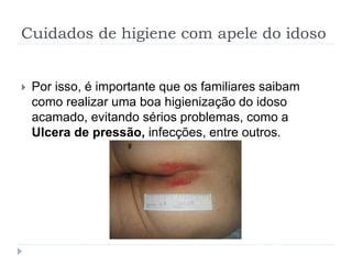 Cuidados de higiene com apele do idoso
 Por isso, é importante que os familiares saibam
como realizar uma boa higienização do idoso
acamado, evitando sérios problemas, como a
Ulcera de pressão, infecções, entre outros.
 