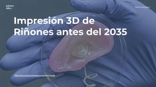 Technologies
Impresión 3D de
Riñones antes del 2035
https://www.youtube.com/watch?v=peeWHtYsmdM
 