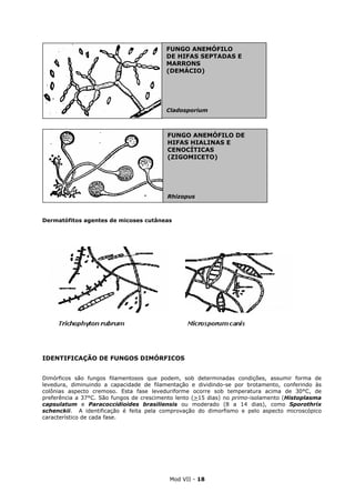 Mod VII - 18
Dermatófitos agentes de micoses cutâneas
Dermatófitos agentes de micoses cutâneas
IDENTIFICAÇÃO DE FUNGOS DIMÓRFICOS
Dimórficos são fungos filamentosos que podem, sob determinadas condições, assumir forma de
levedura, diminuindo a capacidade de filamentação e dividindo-se por brotamento, conferindo às
colônias aspecto cremoso. Esta fase leveduriforme ocorre sob temperatura acima de 30°C, de
preferência a 37°C. São fungos de crescimento lento (>15 dias) no primo-isolamento (Histoplasma
capsulatum e Paracoccidioides brasiliensis ou moderado (8 a 14 dias), como Sporothrix
schenckii. A identificação é feita pela comprovação do dimorfismo e pelo aspecto microscópico
característico de cada fase.
FUNGO ANEMÓFILO DE
HIFAS HIALINAS E
CENOCÍTICAS
(ZIGOMICETO)
Rhizopus
FUNGO ANEMÓFILO
DE HIFAS SEPTADAS E
MARRONS
(DEMÁCIO)
Cladosporium
 