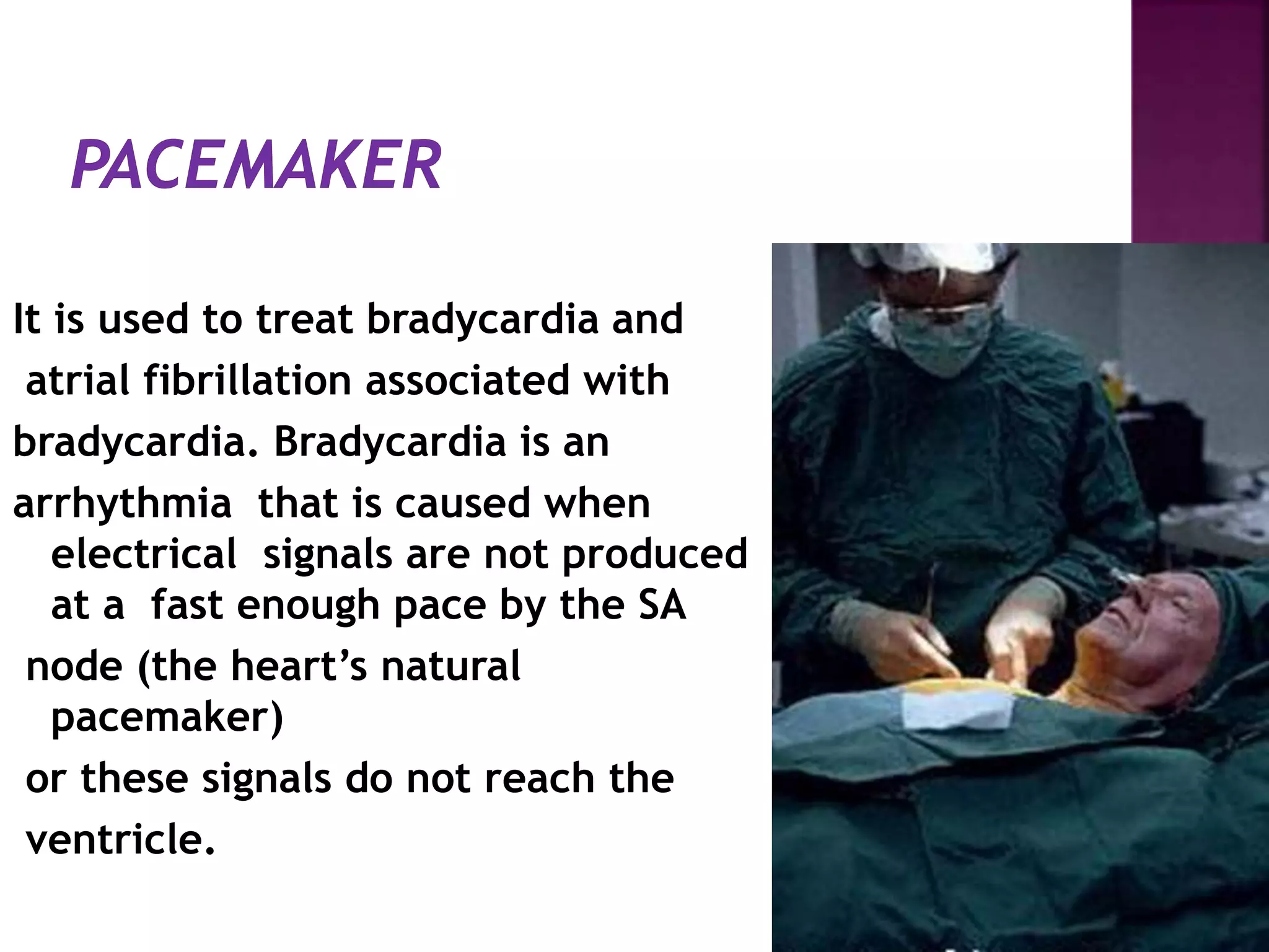 It is used to treat bradycardia and
atrial fibrillation associated with
bradycardia. Bradycardia is an
arrhythmia that is caused when
electrical signals are not produced
at a fast enough pace by the SA
node (the heart’s natural
pacemaker)
or these signals do not reach the
ventricle.
 