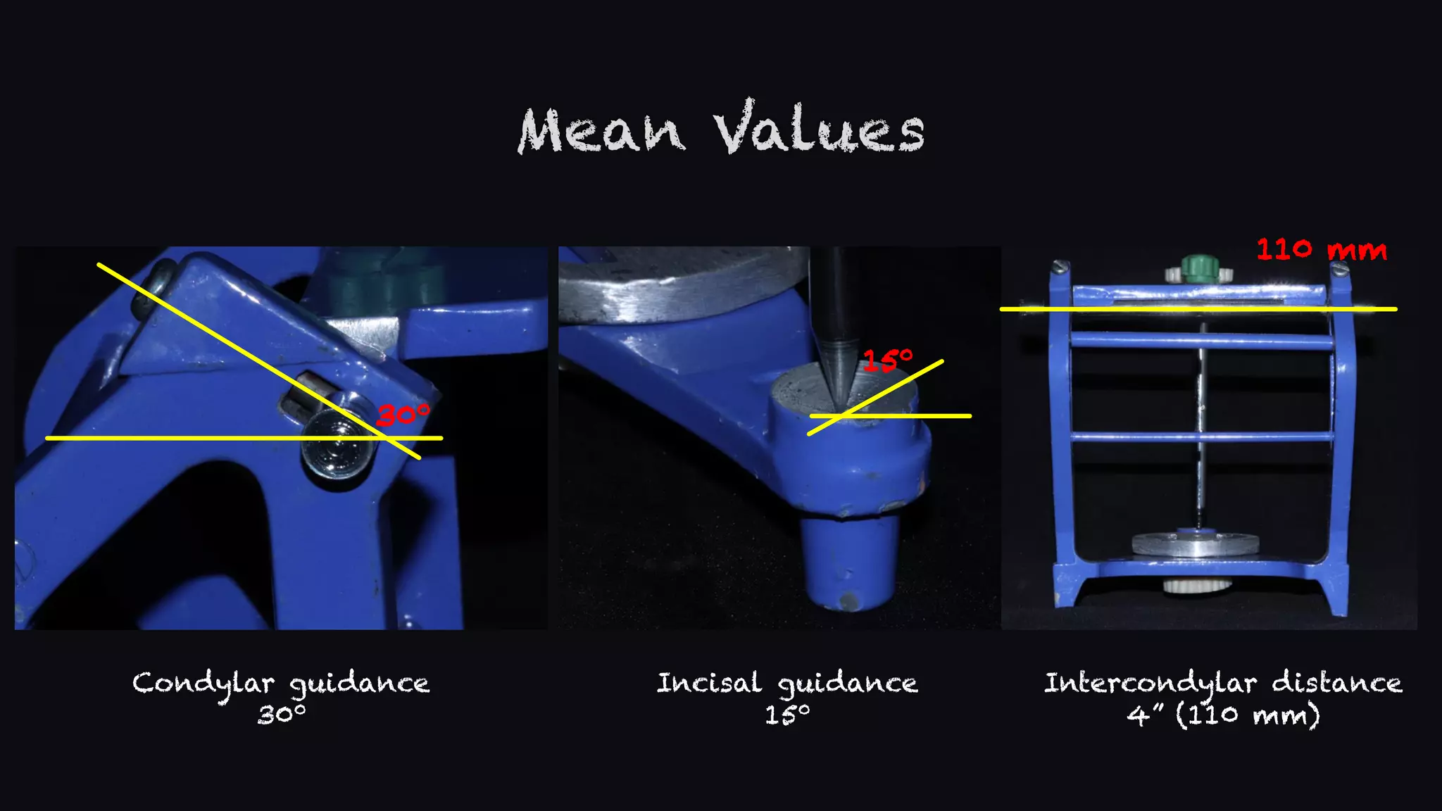 mean-value-articulator