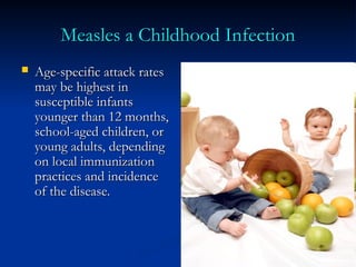 Comprehensive Overview of Measles: Symptoms, Transmission, and ...