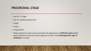 PRODROMAL STAGE
• Last for 3-5 days
• Low to moderate grade fever
• Cough
• Coryza
• Conjunctivitis
• These symptoms nearly almost precedes the appearance of KOPLIKS spots(whitish
spots, presents on buccal mucosa opposite to lower molar,Pathogonomic sign of
measles)by 2-3 days
 