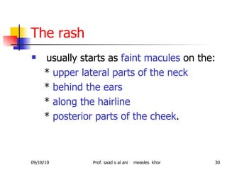 The rash usually starts as  faint macules  on the:  *  upper lateral parts of the neck *  behind the ears *  along the hairline   *  posterior parts of the cheek .  