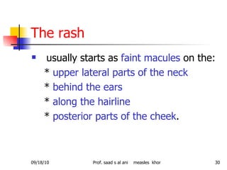 The rash <ul><li>usually starts as  faint macules  on the:  </li></ul><ul><li>*  upper lateral parts of the neck </li></ul...