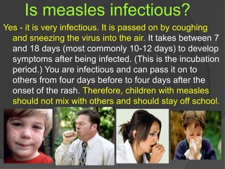 Is measles infectious?
Yes - it is very infectious. It is passed on by coughing
and sneezing the virus into the air. It takes between 7
and 18 days (most commonly 10-12 days) to develop
symptoms after being infected. (This is the incubation
period.) You are infectious and can pass it on to
others from four days before to four days after the
onset of the rash. Therefore, children with measles
should not mix with others and should stay off school.
 