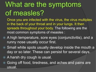 What are the symptoms
of measles?
Once you are infected with the virus, the virus multiples
in the back of your throat and in your lungs. It then
spreads throughout your body. The following are the
most common symptoms of measles :
 A high temperature, sore eyes (conjunctivitis), and a
runny nose usually occur first.
 Small white spots usually develop inside the mouth a
day or so later. These can persist for several days.
 A harsh dry cough is usual.
 Going off food, tiredness, and aches and pains are
usual.
 