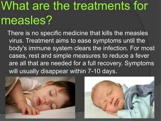 What are the treatments for
measles?
There is no specific medicine that kills the measles
virus. Treatment aims to ease symptoms until the
body's immune system clears the infection. For most
cases, rest and simple measures to reduce a fever
are all that are needed for a full recovery. Symptoms
will usually disappear within 7-10 days.
 