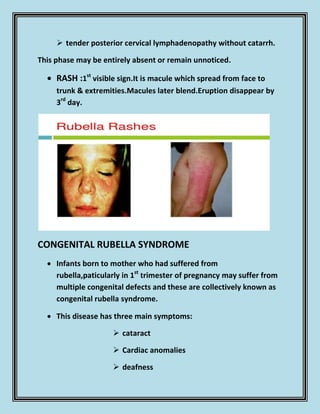 Measles | PDF