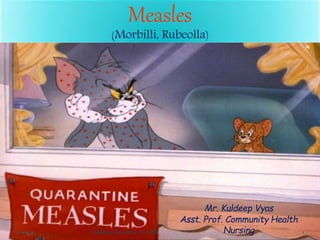 Measles
(Morbilli, Rubeolla)
Mr. Kuldeep Vyas
Asst. Prof. Community Health
Nursing11-06-20 1Kuldeep Vyas M.Sc. N. CHN
 