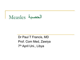 Measles ‫الحصبة‬
Dr Paul T Francis, MD
Prof. Com Med, Zawiya
7th April Uni., Libya
 