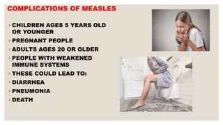 COMPLICATIONS OF MEASLES
◦ CHILDREN AGES 5 YEARS OLD
OR YOUNGER
◦ PREGNANT PEOPLE
◦ ADULTS AGES 20 OR OLDER
◦ PEOPLE WITH WEAKENED
IMMUNE SYSTEMS
◦ THESE COULD LEAD TO:
◦ DIARRHEA
◦ PNEUMONIA
◦ DEATH
 