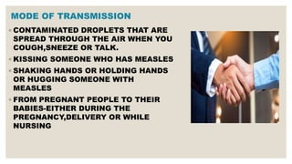 MODE OF TRANSMISSION
◦ CONTAMINATED DROPLETS THAT ARE
SPREAD THROUGH THE AIR WHEN YOU
COUGH,SNEEZE OR TALK.
◦ KISSING SOMEONE WHO HAS MEASLES
◦ SHAKING HANDS OR HOLDING HANDS
OR HUGGING SOMEONE WITH
MEASLES
◦ FROM PREGNANT PEOPLE TO THEIR
BABIES-EITHER DURING THE
PREGNANCY,DELIVERY OR WHILE
NURSING
 