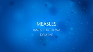 MEASLES
JAMES THUTHUWA
DCM-ME
 