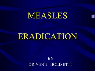 MEASLES
ERADICATION
BY
DR.VENU BOLISETTI
 