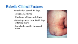 Rubella Clinical Features
• Incubation period: 14 days
(range 12-23 days)
• Prodrome of low-grade fever
• Maculopapular rash: 14-17 days
after exposure
• Lymphadenopathy in second
week
 