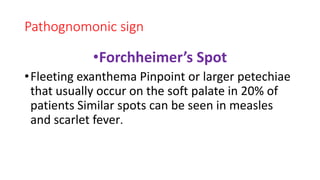 Pathognomonic sign
•Forchheimer’s Spot
•Fleeting exanthema Pinpoint or larger petechiae
that usually occur on the soft palate in 20% of
patients Similar spots can be seen in measles
and scarlet fever.
 