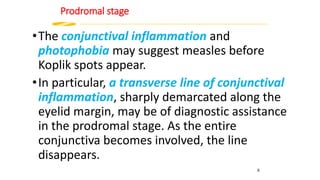 Prodromal stage
•The conjunctival inflammation and
photophobia may suggest measles before
Koplik spots appear.
•In particular, a transverse line of conjunctival
inflammation, sharply demarcated along the
eyelid margin, may be of diagnostic assistance
in the prodromal stage. As the entire
conjunctiva becomes involved, the line
disappears.
8
 