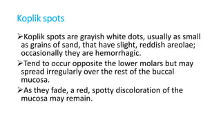 Koplik spots
Koplik spots are grayish white dots, usually as small
as grains of sand, that have slight, reddish areolae;
occasionally they are hemorrhagic.
Tend to occur opposite the lower molars but may
spread irregularly over the rest of the buccal
mucosa.
As they fade, a red, spotty discoloration of the
mucosa may remain.
 
