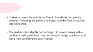 Measles .pptx
