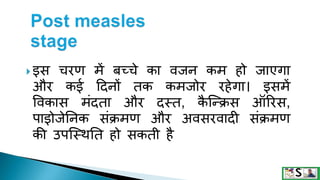Measles in hindi. ,measles | PPTX