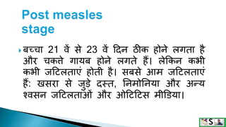 Measles in hindi. ,measles | PPTX