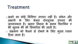 Measles in hindi. ,measles | PPTX