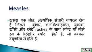 Measles in hindi. ,measles | PPTX