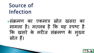 Measles in hindi. ,measles | PPTX
