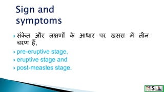 Measles in hindi. ,measles | PPTX