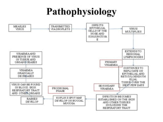 Pathophysiology
 