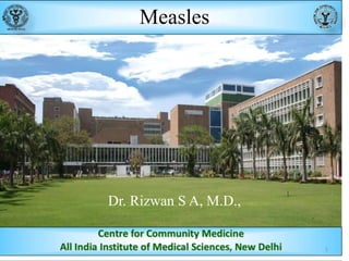 Measles

Dr. Rizwan S A, M.D.,

1

 