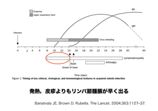 Banatvala JE, Brown D. Rubella. The Lancet. 2004;363:1127‒37.
発熱，皮疹よりもリンパ節腫脹が早く出る
 
