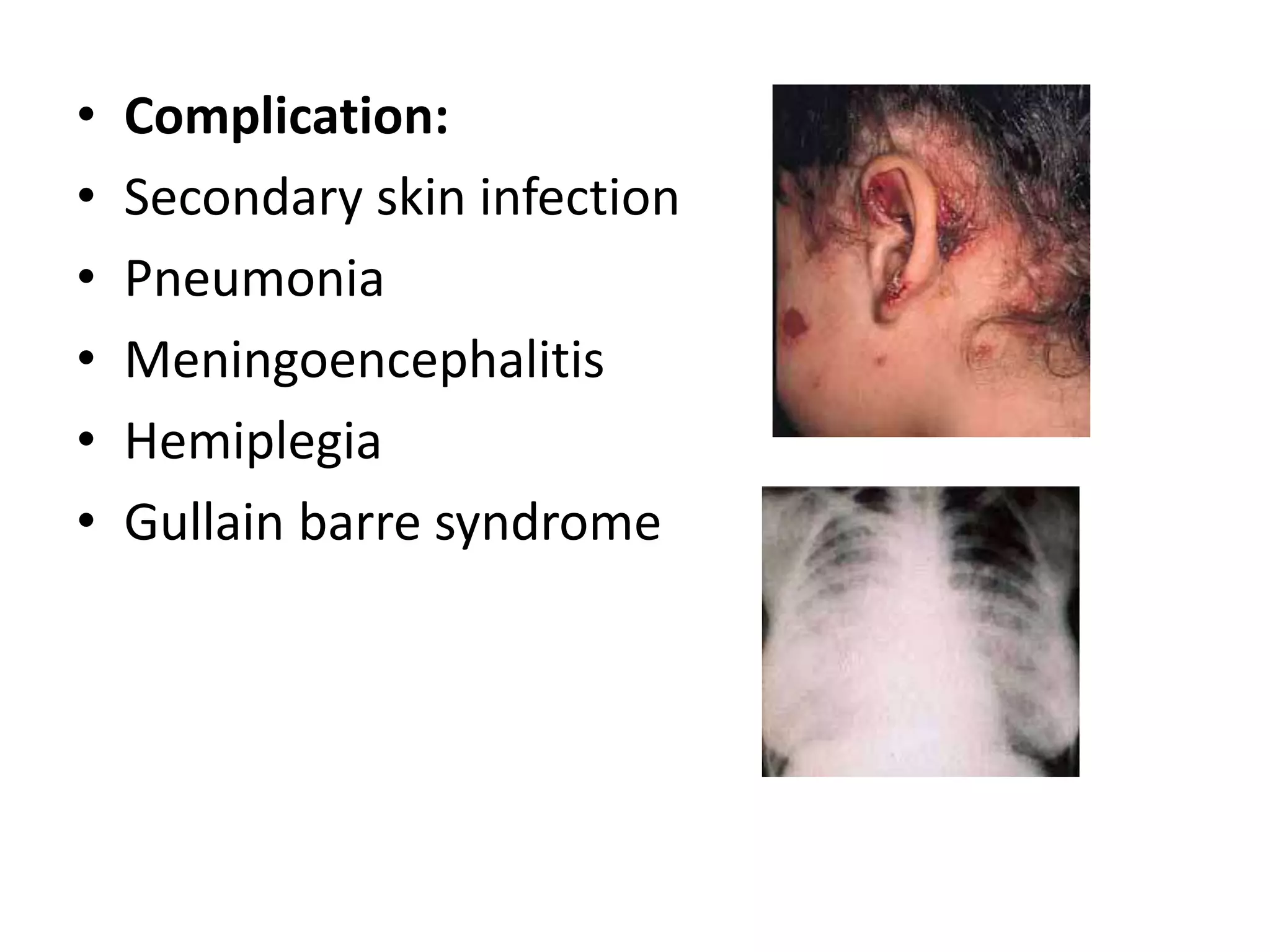 Eela Rashes fever with rash in pediatric age groups | PPTX
