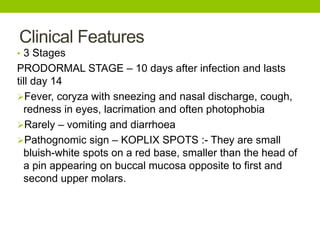 Clinical Features
• 3 Stages
PRODORMAL STAGE – 10 days after infection and lasts
till day 14
Fever, coryza with sneezing and nasal discharge, cough,
redness in eyes, lacrimation and often photophobia
Rarely – vomiting and diarrhoea
Pathognomic sign – KOPLIX SPOTS :- They are small
bluish-white spots on a red base, smaller than the head of
a pin appearing on buccal mucosa opposite to first and
second upper molars.
 