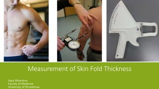 Measurement of Skin Fold Thickness
Yapa Wijeratne
Faculty of Medicine
University of Peradeniya
 