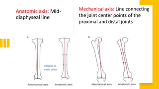 Anatomic axis: Mid-
diaphyseal line
Mechanical axis: Line connecting
the joint center points of the
proximal and distal joints
Parallel to
each other
 
