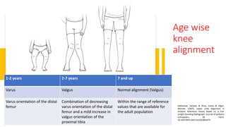 Age wise
knee
alignment
1-2 years 2-7 years 7 and up
Varus Valgus Normal alignment (Valgus)
Varus orientation of the distal
femur
Combination of decreasing
varus orientation of the distal
femur and a mild increase in
valgus orientation of the
proximal tibia
Within the range of reference
values that are available for
the adult population
Sabharwal, Sanjeev & Zhao, Caixia & Edgar,
Michele. (2007). Lower Limb Alignment in
Children Reference Values Based on a Full-
Length Standing Radiograph. Journal of pediatric
orthopedics. 28. 740-6.
10.1097/BPO.0b013e318186eb79.
 