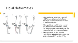Tibial deformities
• If the ipsilateral femur has a normal
mLDFA, extend its mechanical axis
distally to become the mechanical axis
of the proximal tibia
• If the ipsilateral mLDFA is not normal
but the contralateral MPTA is normal,
use the contralateral MPTA to draw the
mechanical axis of the proximal tibia.
• If the ipsilateral mLDFA and the
contralateral MPTA are not normal, use
a normal value (87°) for the MPTA.
 