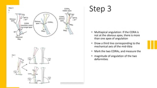Step 3
• Multiapical angulation: If the CORA is
not at the obvious apex, there is more
than one apex of angulation
• Draw a third line corresponding to the
mechanical axis of the mid-tibia
• Mark the two CORAs, and measure the
• magnitude of angulation of the two
deformities
 