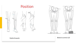 Position
Patella forwards Blocks to correct LLD
 