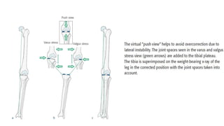 Measurements around knee