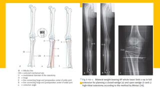 Measurements around knee