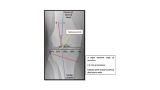 Measurements around knee