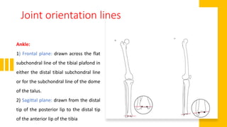 Joint orientation lines
Ankle:
1) Frontal plane: drawn across the flat
subchondral line of the tibial plafond in
either the distal tibial subchondral line
or for the subchondral line of the dome
of the talus.
2) Sagittal plane: drawn from the distal
tip of the posterior lip to the distal tip
of the anterior lip of the tibia
 