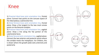 Knee
1) Proximal tibial knee joint orientation line, frontal
plane: Connect two points on the concave aspect of
the tibial plateau subchondral line.
2) Distal femoral knee joint orientation line, frontal
plane: Draw a line tangent to the two most convex
points on the femoral condyles.
3) Proximal tibial knee joint orientation line, sagittal
plane: Draw a line along the fiat portion of the
subchondral bone.
4) Distal femoral joint orientation line, sagittal plane:
Connect the two anterior and posterior points where
the condyle meets the metaphysis. For children, this
is drawn where the growth plate exits anteriorly and
posteriorly
 